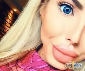女子沉迷于整形只为成为真人芭比