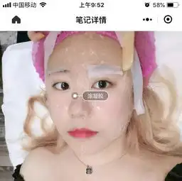 惊了大s无处安放的少女感源自台湾的皮秒镭射净肤无针水光只要399,与女明星一起冻龄