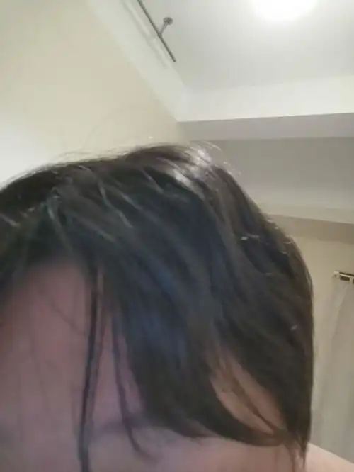 自然卷过于严重应该怎么办