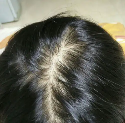 绿头发头像女生脱发