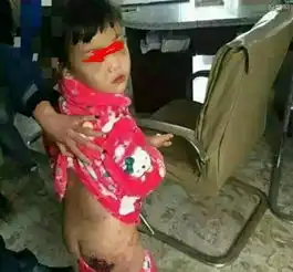 母亲虐女伤口撒盐手段极度残忍暴力