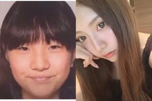 女生被偶像嫌丑悄悄去整容,变美后交往成功,男星醒后发现遭了