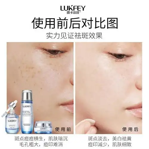 淡斑产品推荐这几款宝藏祛斑产品,让斑斑女孩远离斑点烦恼