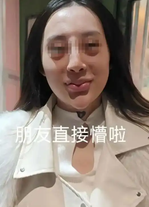 吉林女子整容后遭男友嫌弃分手哭泣,闺蜜见后懵了根本不敢看了