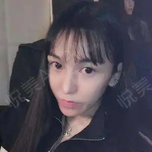 之前是学生风,这星期是温柔风,暗黑朋克风朋友都说...眼综合悦美整形