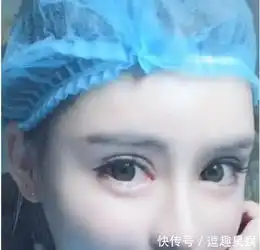 抖音整容脸护士火了,热巴的大眼杨颖的嘴,网友这整得可以