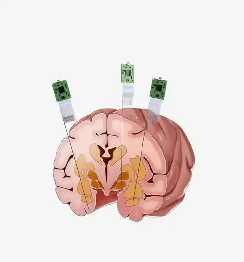 突破性成果祝贺我国科学家
