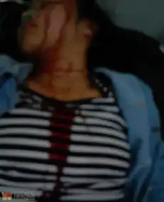 南溪四中暴力事件初一女生遭初三的伙同4社会女青年挟持暴打满头是血