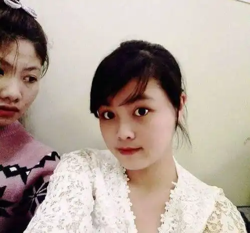 女子被前夫毁容做了16次手术,最伤心的是女儿看到她不敢靠近