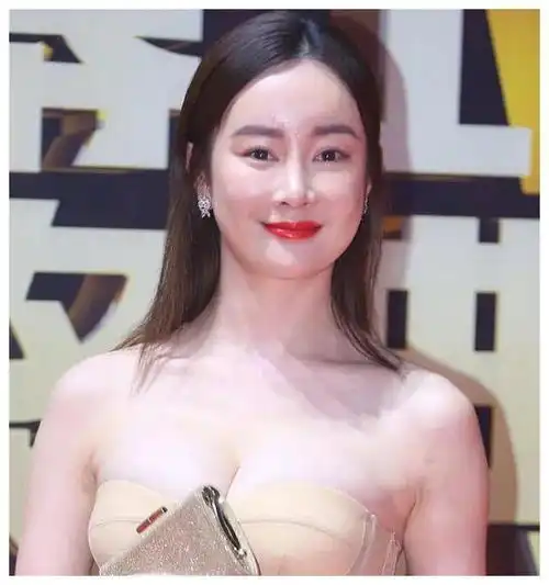 长得很美却还要整容的5位女星,张檬孙菲菲太可惜,她完全认不出