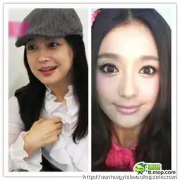 大饼变锥子当红女星削骨前后震撼大对比