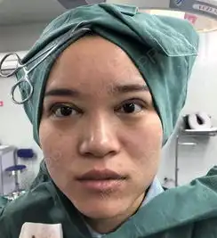 和很多女孩子一样,我也希望有一双闪亮亮的大眼睛,但...眼整形失败修复悦美整形