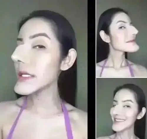 漂亮女孩花费将近百万,将自己整成老巫婆,还觉得自己特别的漂亮