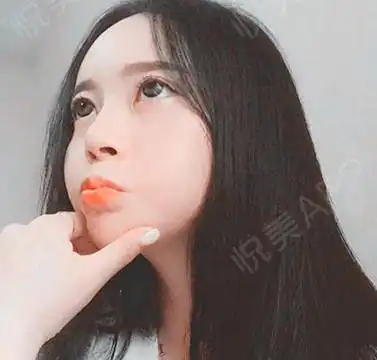 人人都说太瘦的女人不好看,但是又有人羡慕一种狂吃不...面部填充悦美整形