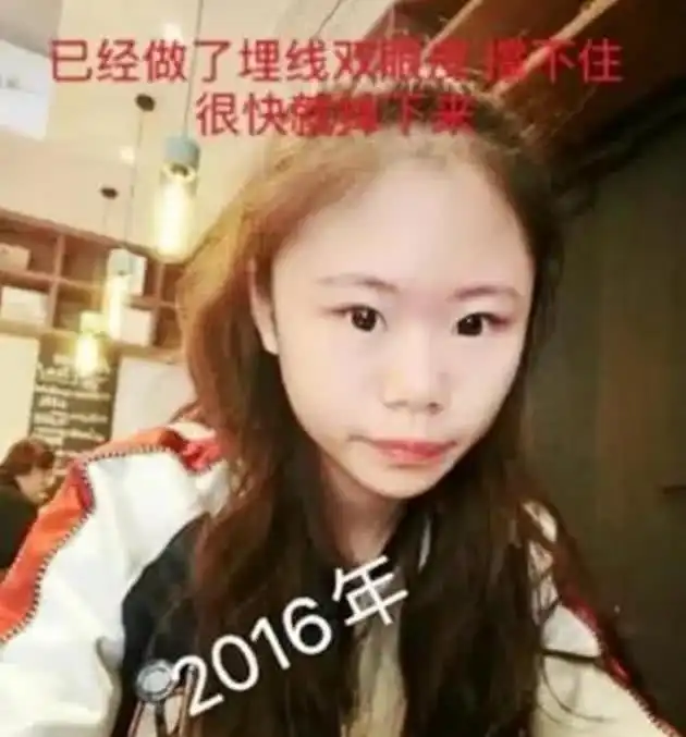 13岁女孩沉迷整容,3年间花近百万整了60次,网友不如不整