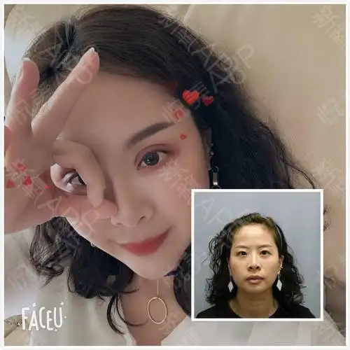 为什么脂肪胶这么贵