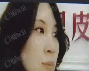 女子微整形变毁容学员看两次手术就在人脸动刀