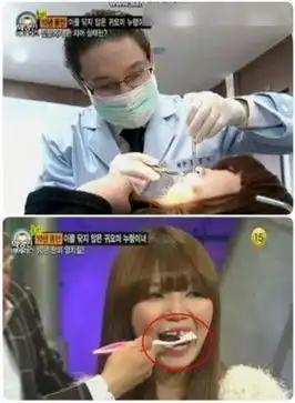 图揭日韩综艺奇葩真人秀少女十年不刷牙登台秀满嘴牙垢146