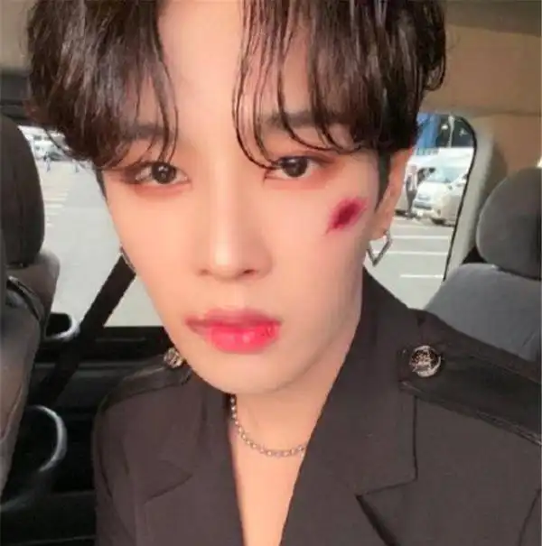 明星遇到受伤妆,鹿晗真实,范丞丞霸气,看到蔡徐坤最新流行