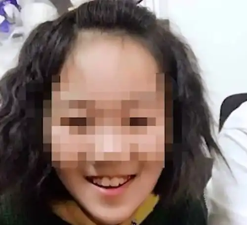 山西一12岁女孩遭继母虐待,皮肤多处溃烂感染,被虐打成植物人