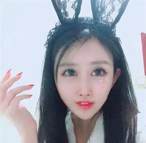 最近拍了一组日系的照片,娃娃的特征就是眼睛大,没有...眼综合悦美整形