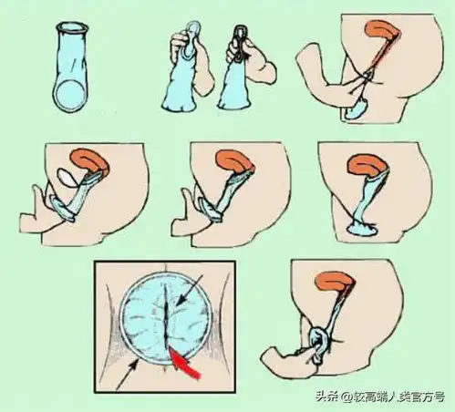 女生戴的套套,长啥样