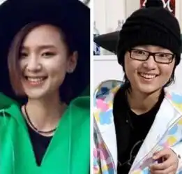 周笔畅整容是怎么回事