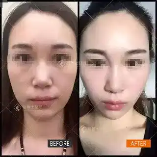 瘦脸宝典让你更美更上镜