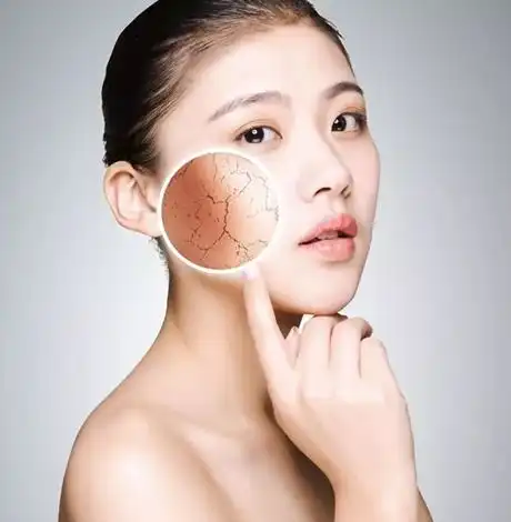 刚做完手术能吃鲈鱼吗