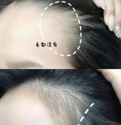 央视曝光洗发水黑名单很多女生都在用,难怪头发越洗越少