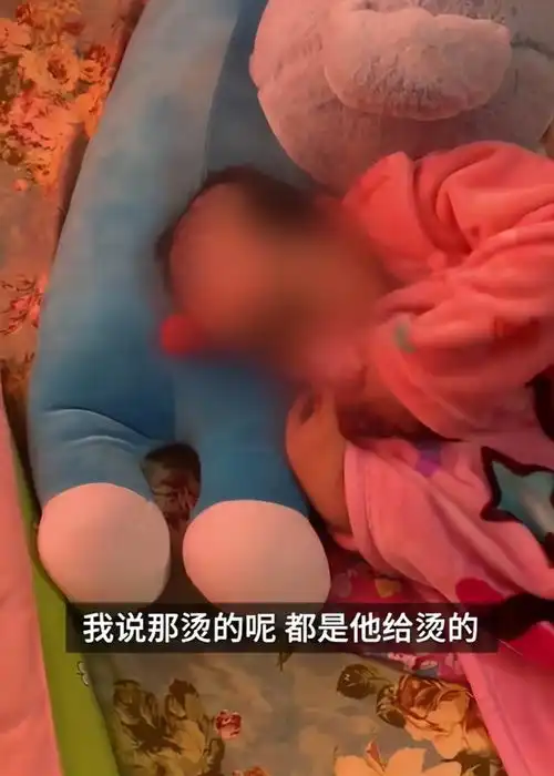 惨绝人寰辽宁6岁女童遭父母开水浇头,铁钳拔牙