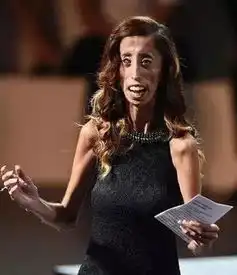 世上最丑的女人又如何,至少她有勇气面对自己