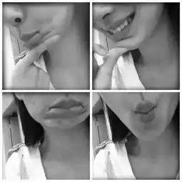 在脸上注射食用油,患整容癖,天然美女却整成妖怪