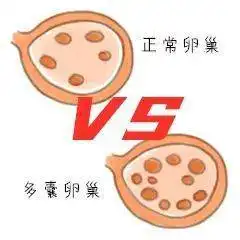 女性青春健康与生育之源的卵巢您有好好保养吗