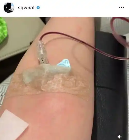 舒淇湿疹再度恶化,戴口罩帽子遮面现身自家面店,生儿育女恐无期