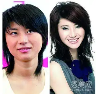 张含韵尚雯婕图揭整容的超女快女们