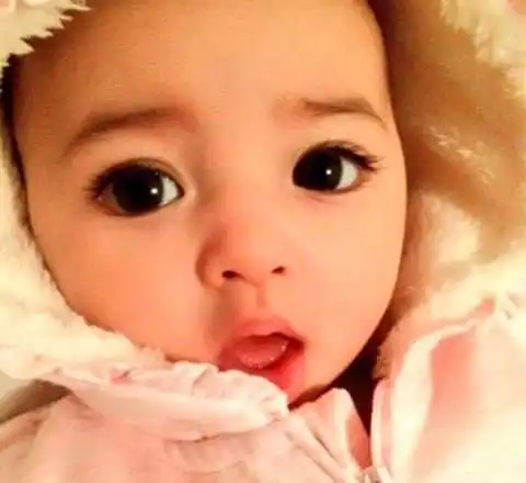 孩子水汪汪的大眼睛,家长要留心,有可能是生病了