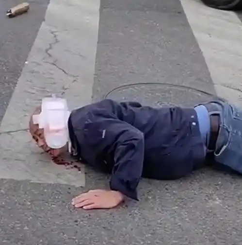 山东女子开车撞到大爷,当场用卫生巾帮忙止血,网友这不吸血吗