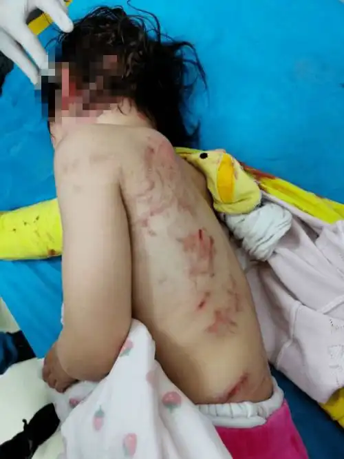 宁宁说常识夏天如何防范狗咬吕洞宾