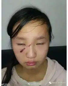 网曝南郑区青树镇,一女生被老师暴力毁容