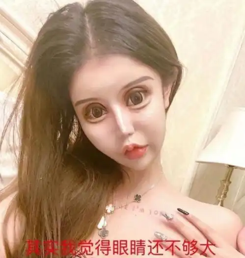 13岁女孩整容上瘾,3年整了60多次,如今画风不忍直视