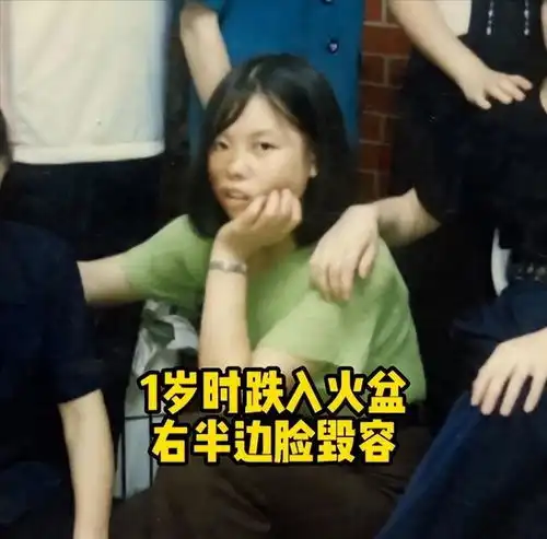 北大高材生不顾一切娶农村毁容女,18年过去了,两人怎么样了