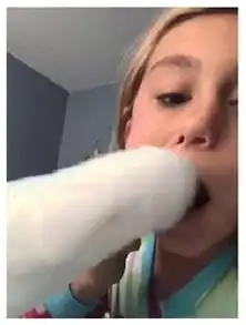 鹦鹉帮小女孩拔牙,全程3秒,利索干脆让人愣住了