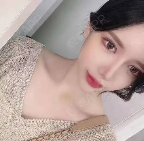 体验很好,接待和操作的美女都很友善项目做起来也很...补水保湿悦美整形