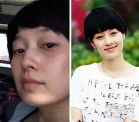 素颜最丑的女明星杨幂baby细纹多周迅长痘