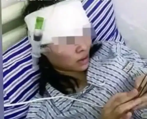 江西南昌女子吊威亚玩网红项目发生事故,竟面临毁容风险