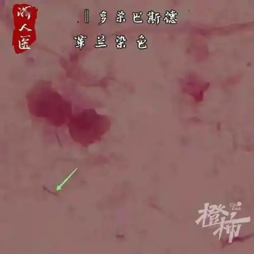 高温天毛孩子突然翻脸,有女子被自家宠物咬伤险截肢