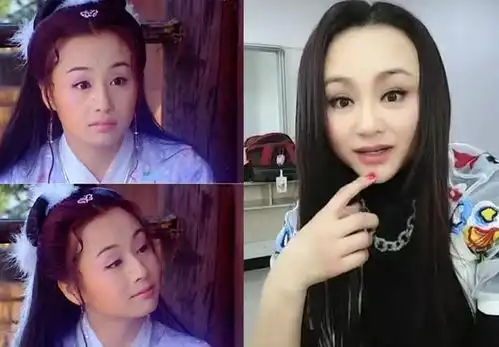女星被玻尿酸毁容,图1像网红,图3像雕塑,最后一位简直了