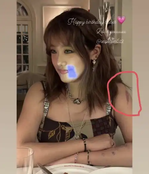 贾静雯大女儿晒19岁生日照,网友质疑像小太妹,手臂疤痕触目惊心