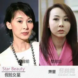 女星整容部位李依晓孙悦萧蔷下巴怪异